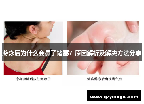 游泳后为什么会鼻子堵塞？原因解析及解决方法分享